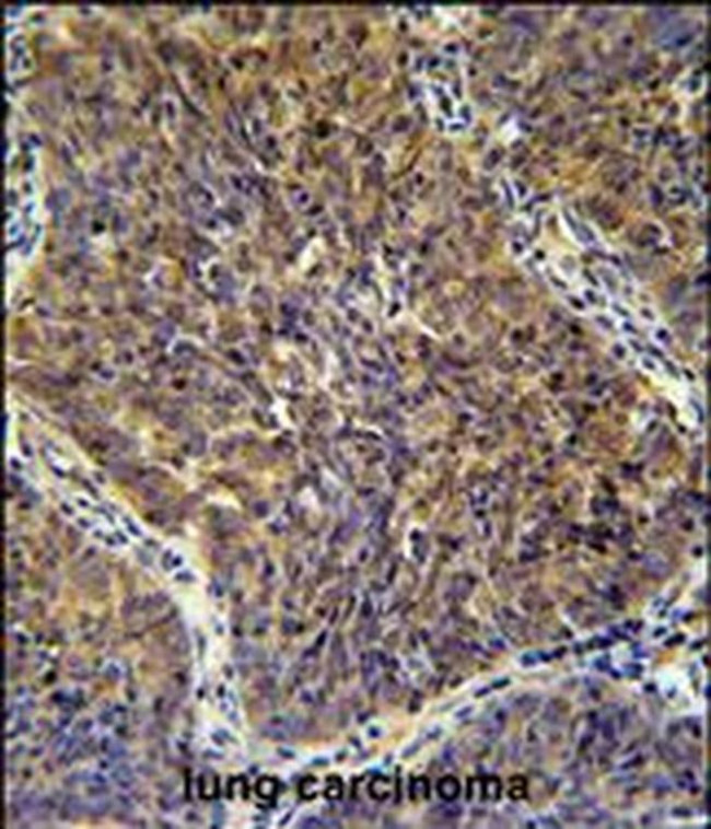 CD2BP2 Antibody in Immunohistochemistry (IHC)