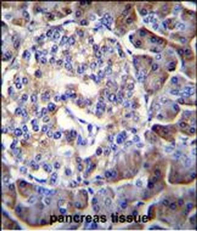 HIP1R Antibody in Immunohistochemistry (IHC)