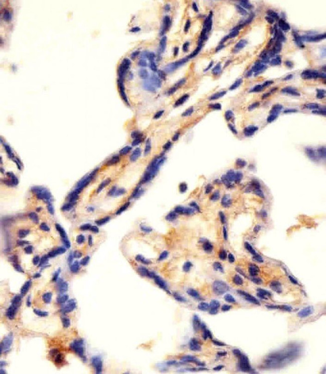 CAD Antibody in Immunohistochemistry (IHC)