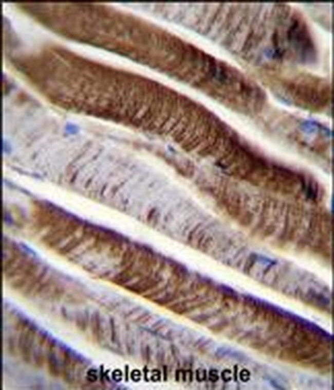 ETFA Antibody in Immunohistochemistry (IHC)