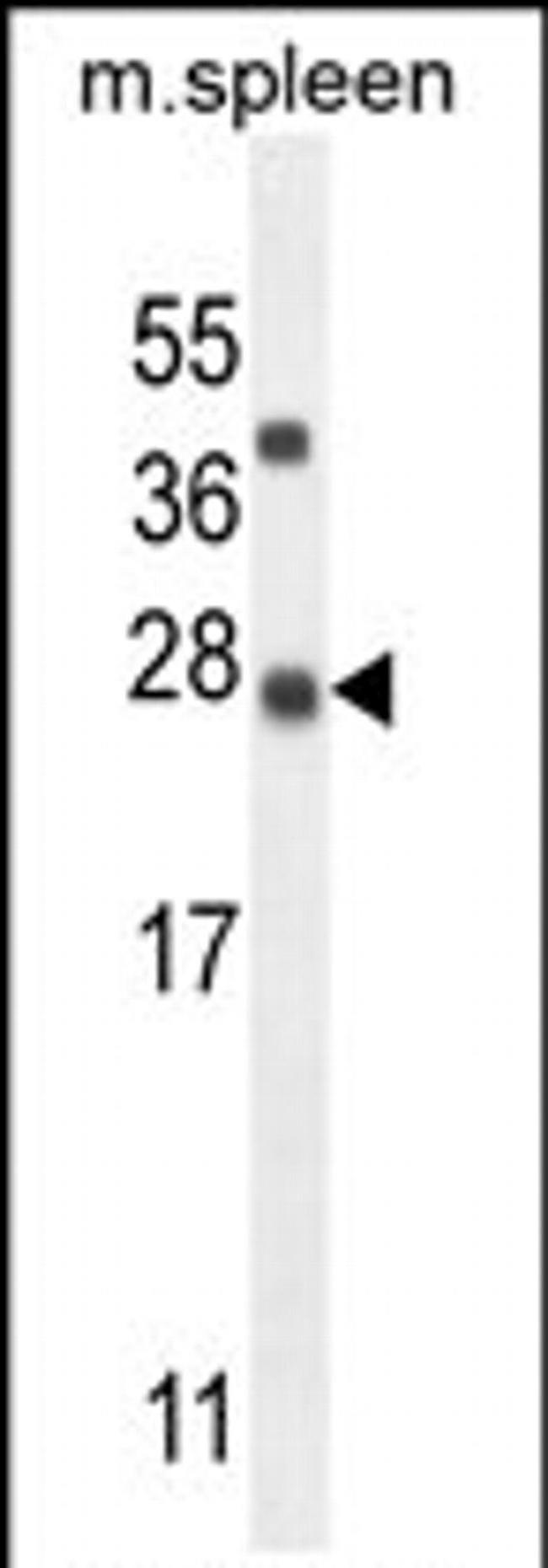 KIAA1143 Antibody in Western Blot (WB)