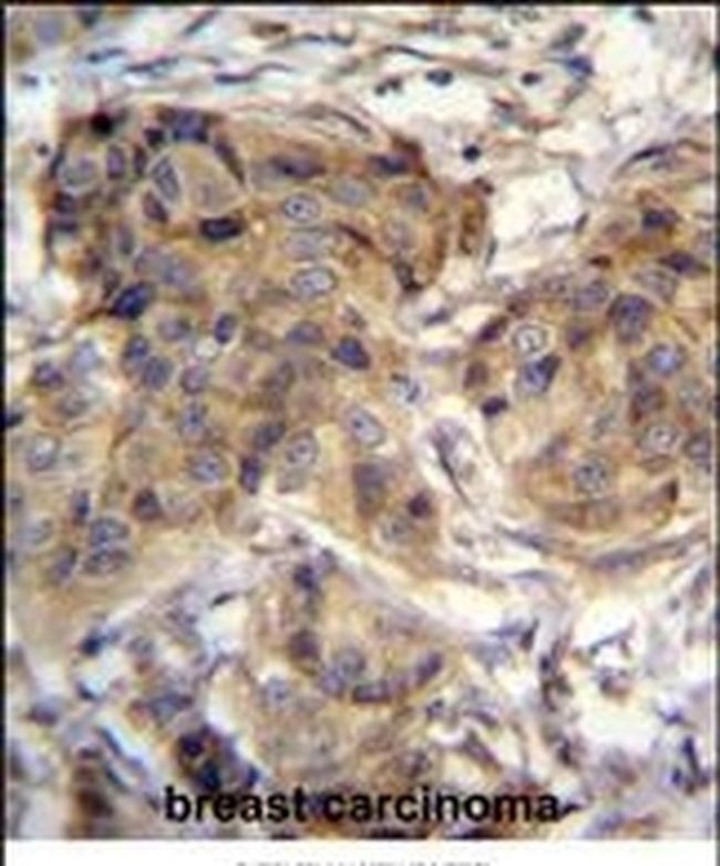 TTC9C Antibody in Immunohistochemistry (IHC)