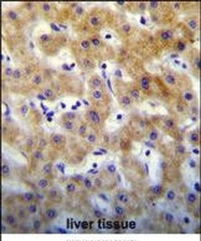 KRTCAP2 Antibody in Immunohistochemistry (IHC)