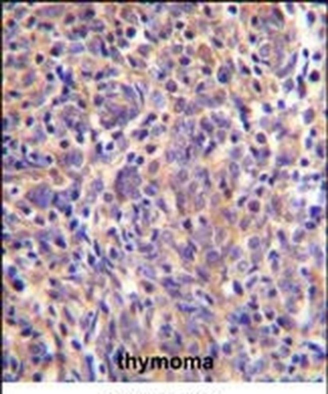 Themis Antibody in Immunohistochemistry (IHC)