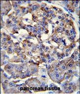 PPP1R37 Antibody in Immunohistochemistry (Paraffin) (IHC (P))