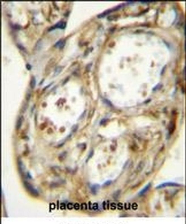 DLK1 Antibody in Immunohistochemistry (IHC)