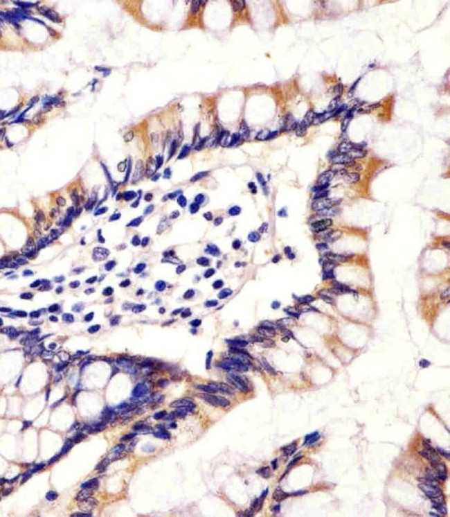 CYP11B2 Antibody in Immunohistochemistry (IHC)