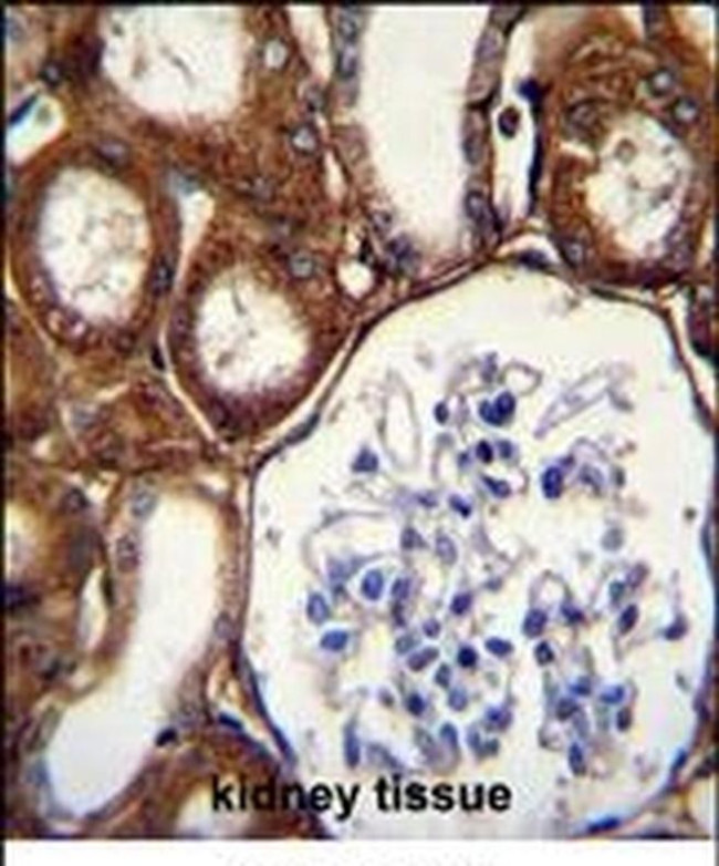 GPX3 Antibody in Immunohistochemistry (IHC)