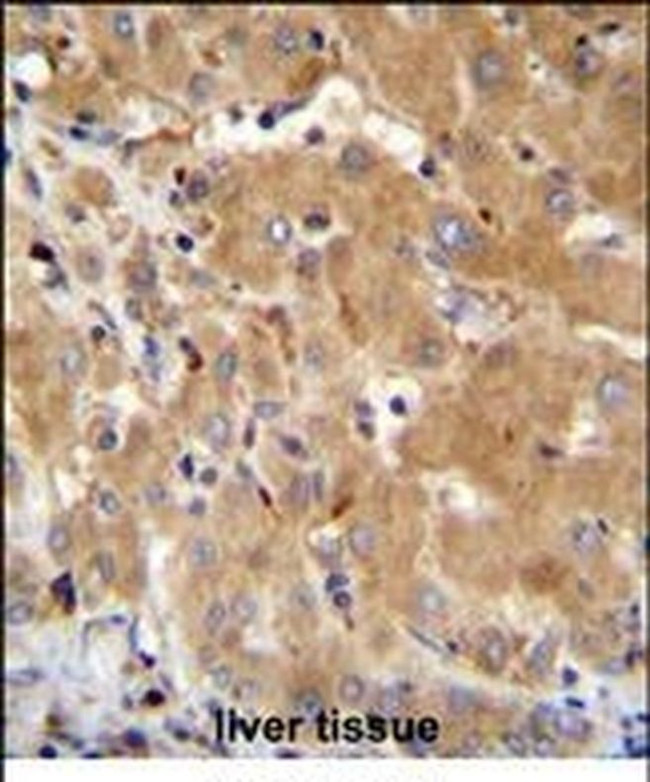 GGH Antibody in Immunohistochemistry (IHC)