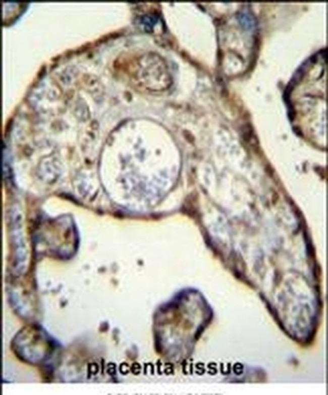 Myeloid Specific Antigen Antibody in Immunohistochemistry (IHC)