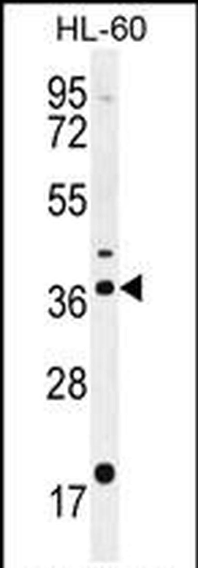 OR2W3 Antibody in Western Blot (WB)