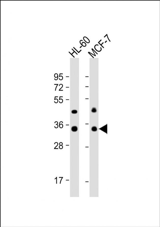 OR10J5 Antibody in Western Blot (WB)