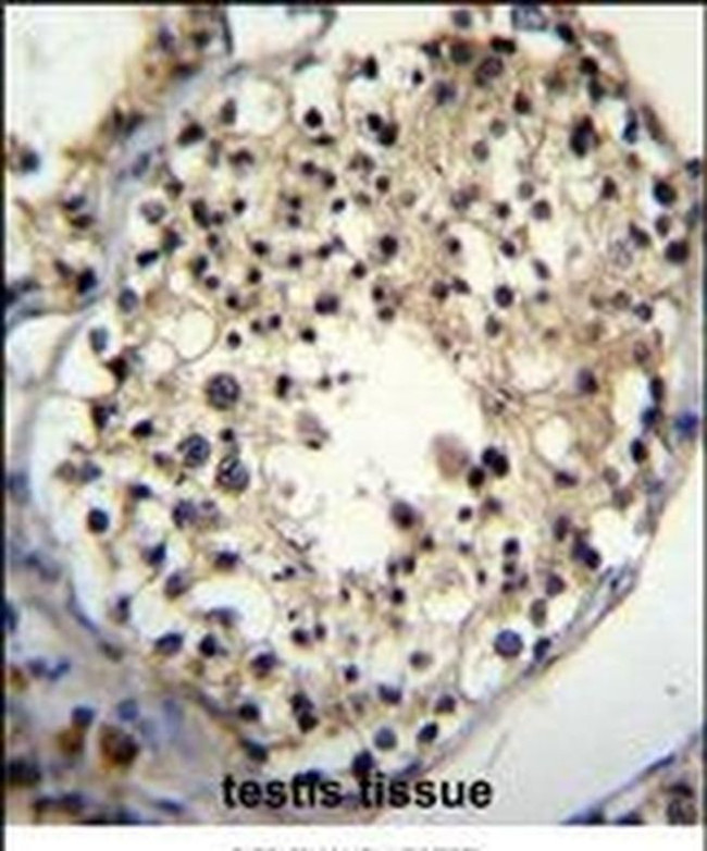 ALKBH6 Antibody in Immunohistochemistry (IHC)