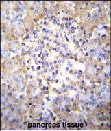 TSNARE1 Antibody in Immunohistochemistry (Paraffin) (IHC (P))
