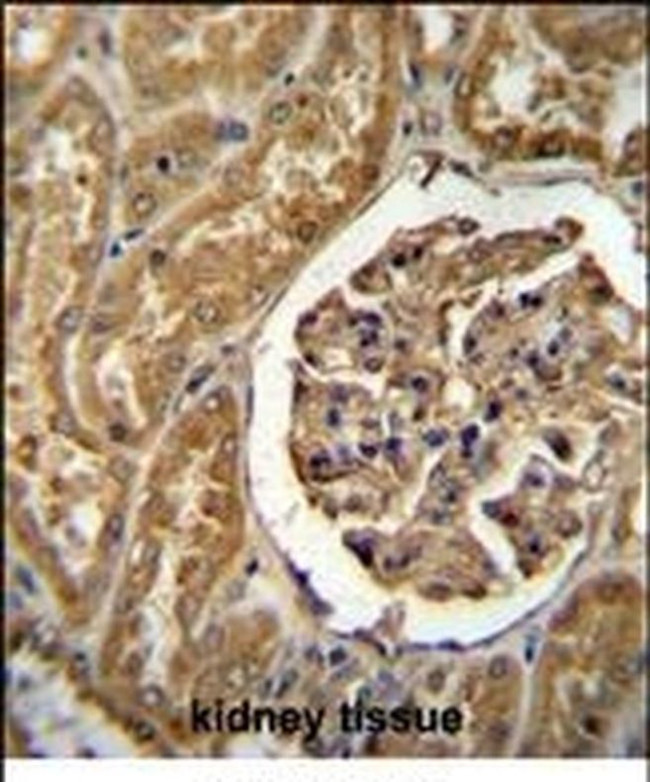 MOGAT1 Antibody in Immunohistochemistry (IHC)