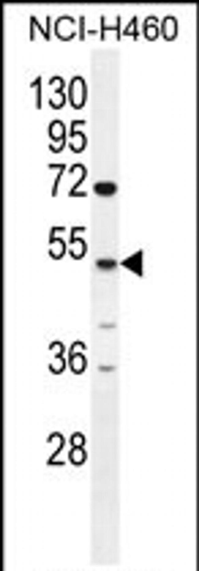 CPA6 Antibody in Western Blot (WB)