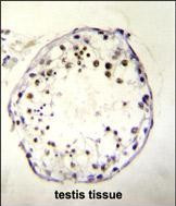 DNAAF3 Antibody in Immunohistochemistry (Paraffin) (IHC (P))