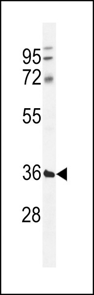 TMCO5B Antibody in Western Blot (WB)