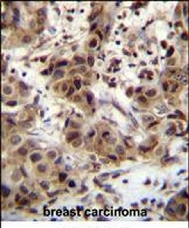 ZNF321P Antibody in Immunohistochemistry (IHC)
