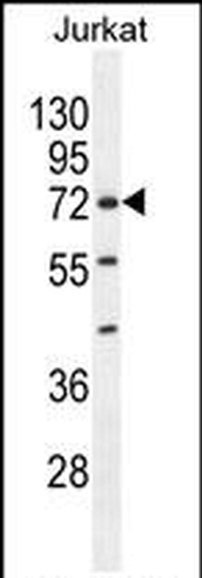 ZNF648 Antibody in Western Blot (WB)