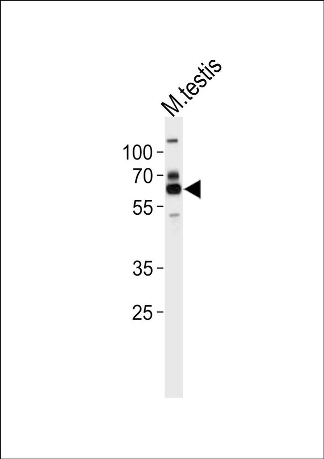ZSCAN5B Antibody in Western Blot (WB)
