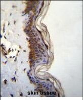 FHAD1 Antibody in Immunohistochemistry (IHC)