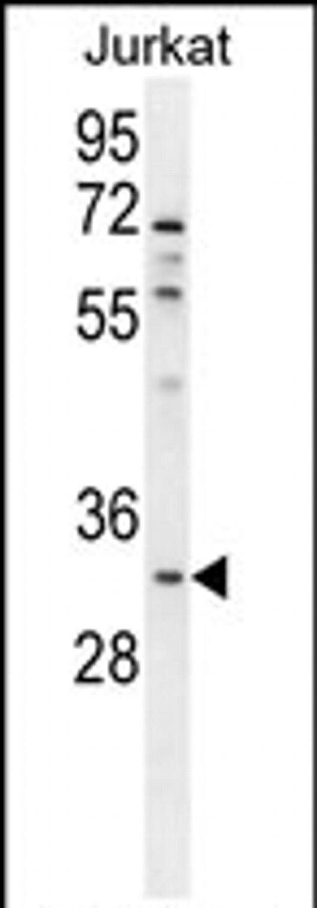OR5B12 Antibody in Western Blot (WB)