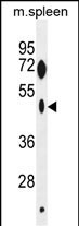 ZNF385C Antibody in Western Blot (WB)