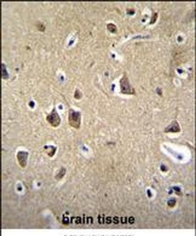 FADS6 Antibody in Immunohistochemistry (IHC)