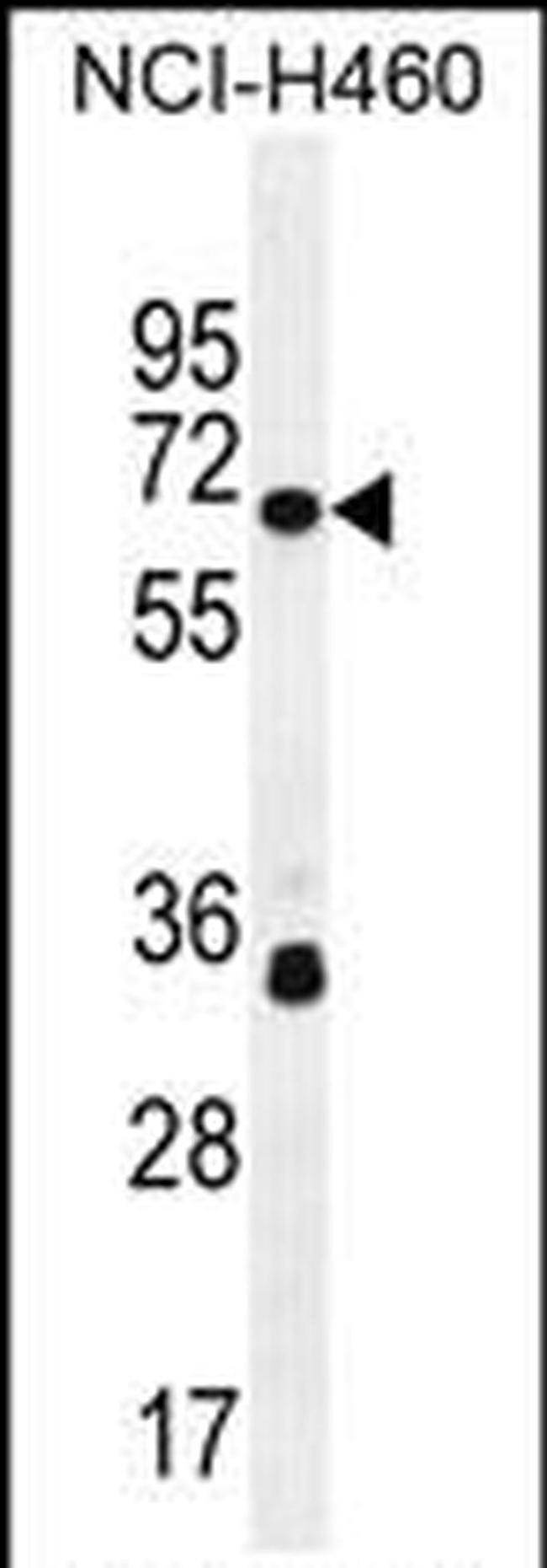 ZNF433 Antibody in Western Blot (WB)