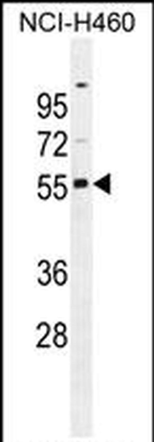 RASSF8 Antibody in Western Blot (WB)