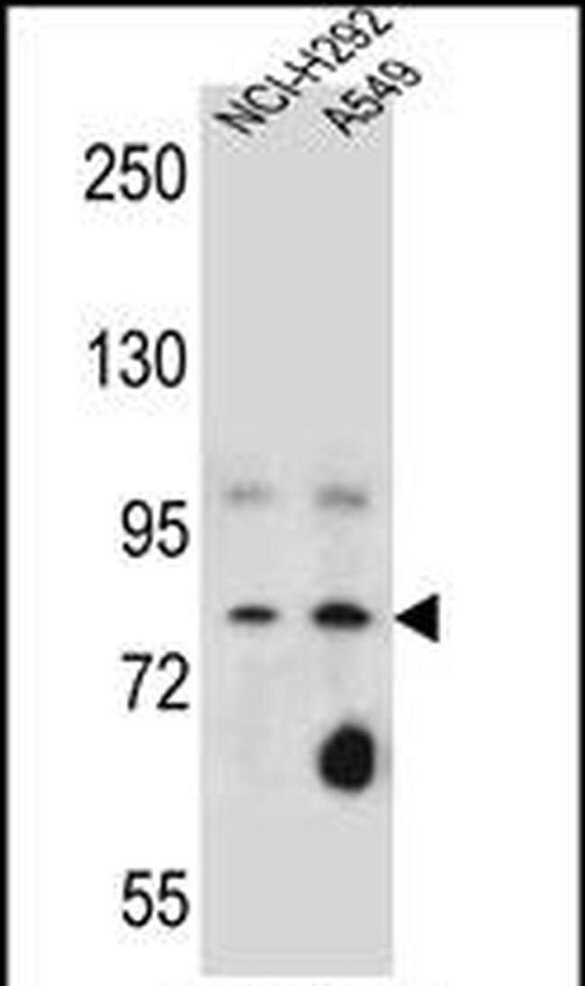 SCEL Antibody in Western Blot (WB)