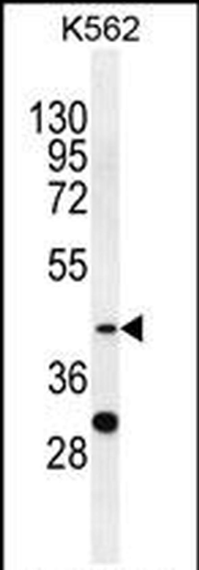 SERPINB4 Antibody in Western Blot (WB)