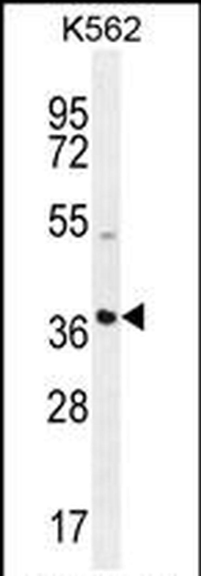 SFRP4 Antibody in Western Blot (WB)
