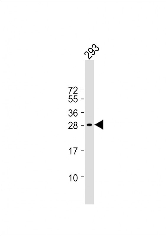 HIDE1 Antibody in Western Blot (WB)