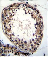 TTC23L Antibody in Immunohistochemistry (Paraffin) (IHC (P))