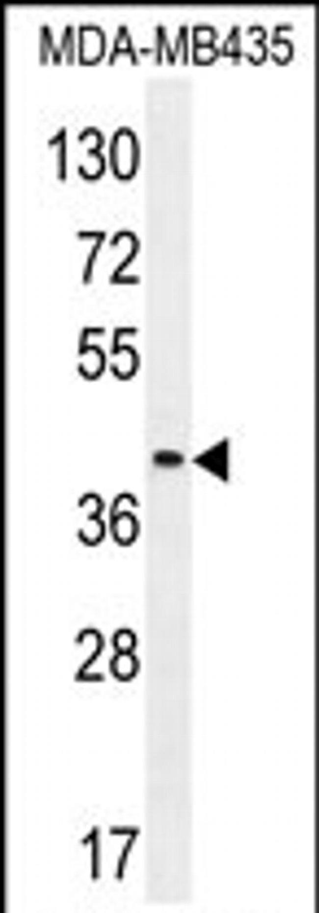LILRA5 Antibody in Western Blot (WB)