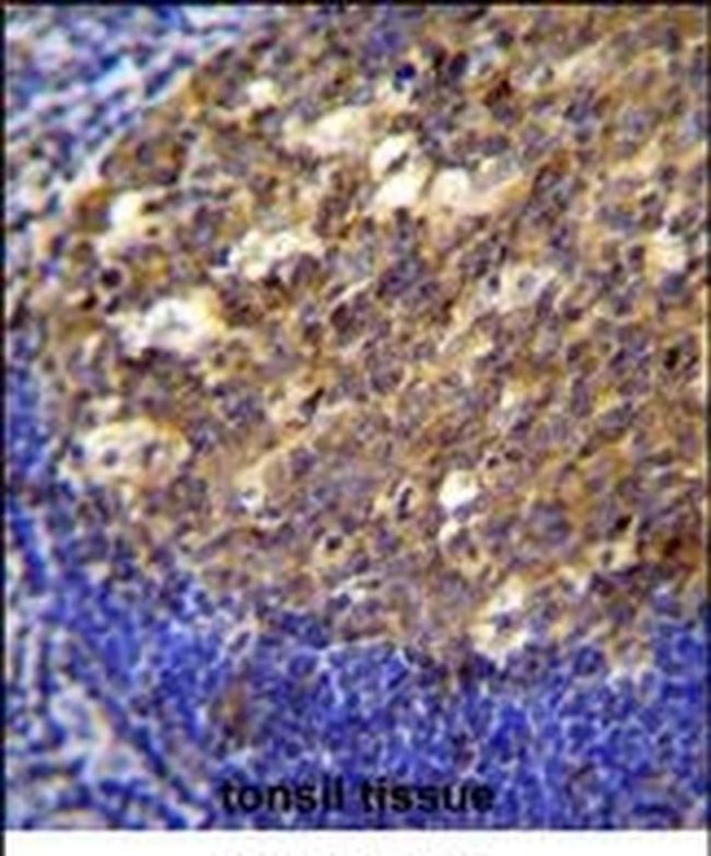 TWF2 Antibody in Immunohistochemistry (IHC)