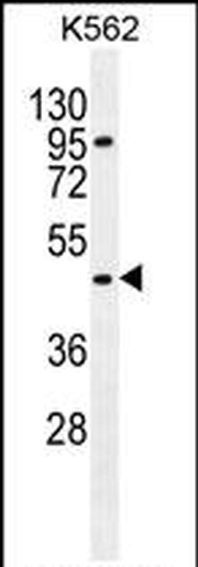 Carboxypeptidase A3 Antibody in Western Blot (WB)