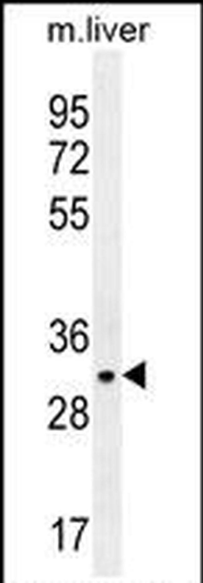 JAZF1 Antibody in Western Blot (WB)