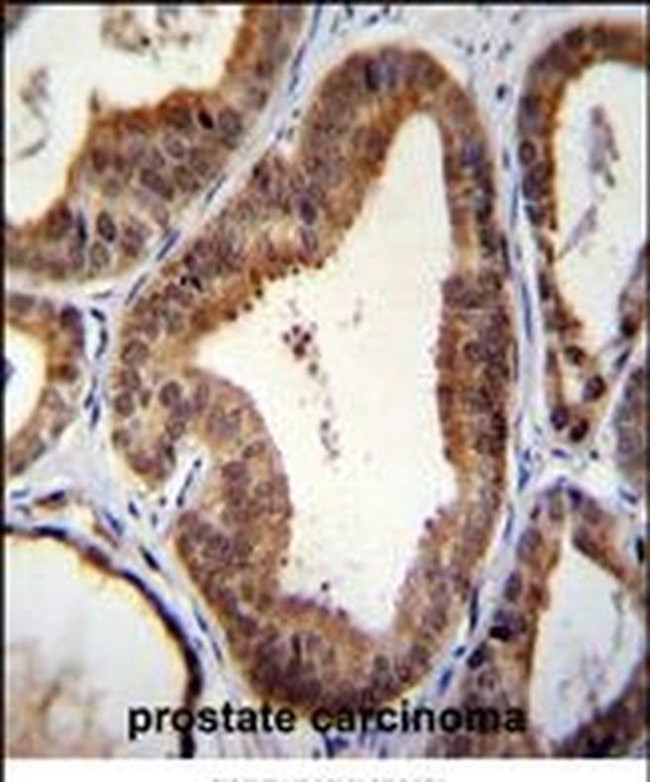 SHQ1 Antibody in Immunohistochemistry (IHC)