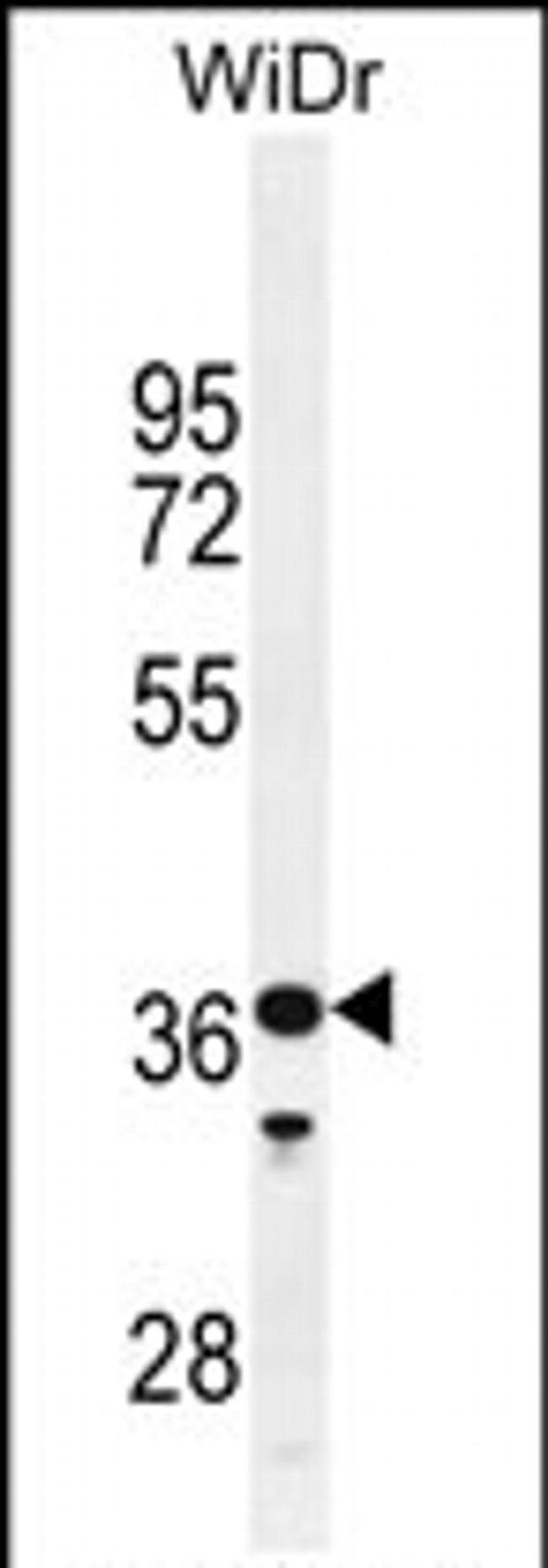 GXYLT1 Antibody in Western Blot (WB)