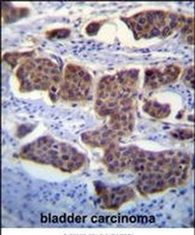 PALM3 Antibody in Immunohistochemistry (IHC)