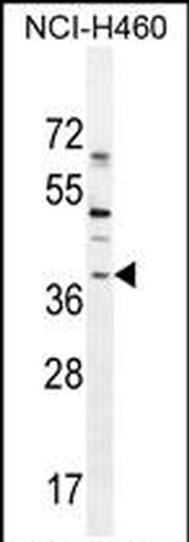 SOX1 Antibody in Western Blot (WB)