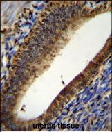 PTMA Antibody in Immunohistochemistry (Paraffin) (IHC (P))
