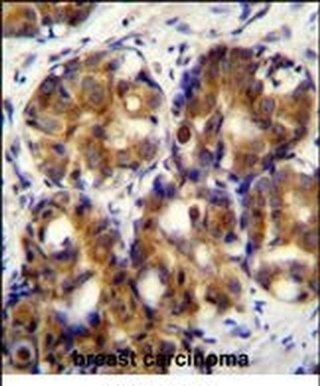 RHAMM Antibody in Immunohistochemistry (IHC)