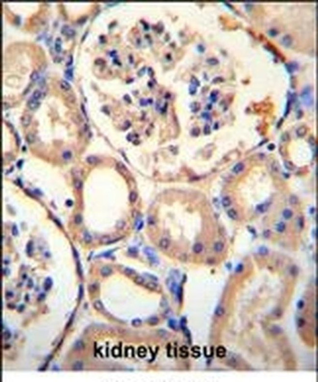 PURA Antibody in Immunohistochemistry (IHC)