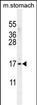 ZNF428 Antibody in Western Blot (WB)