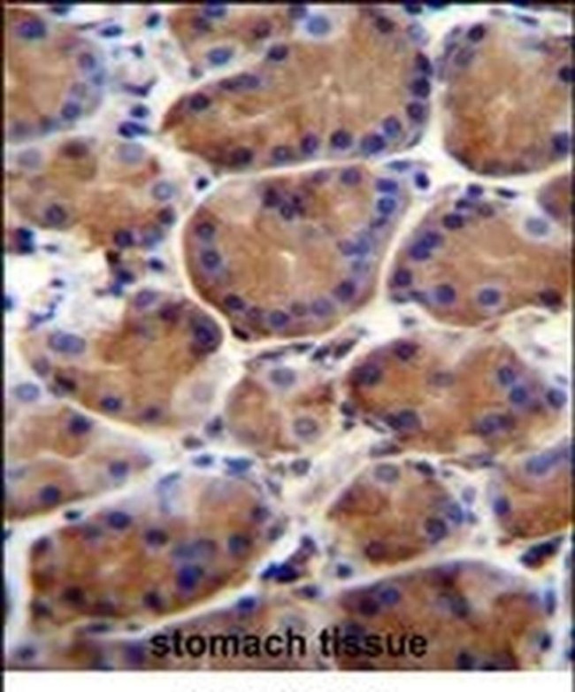 LRWD1 Antibody in Immunohistochemistry (IHC)