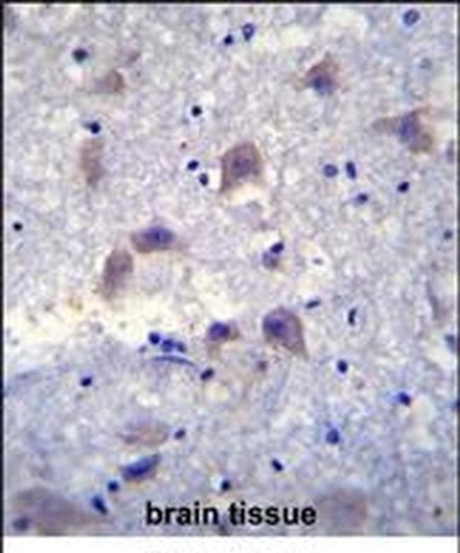 VSIG8 Antibody in Immunohistochemistry (IHC)